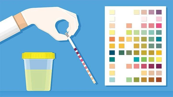 urine-sample-825x510